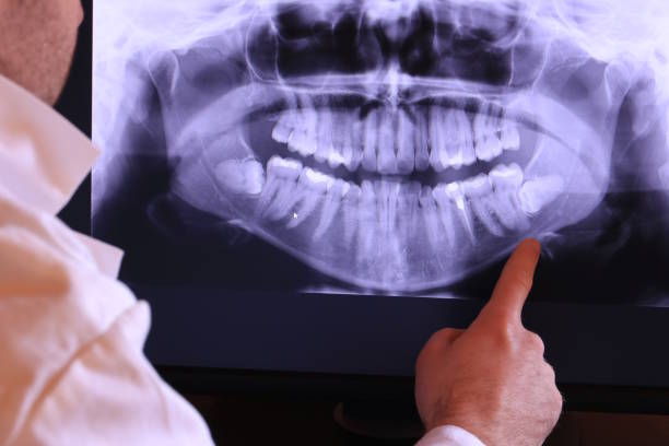 Best Emergency Treatment for Dental Infections or Abscesses in Arlington, MN