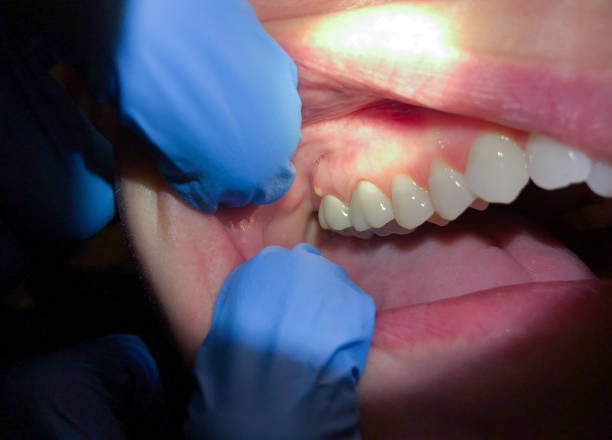 Best Emergency Denture Repair in Arlington, MN